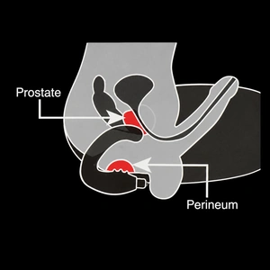 Stimuler prostatan rätt